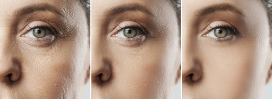 Younger-Looking Eyes: The Importance of Hydration Inside and Out