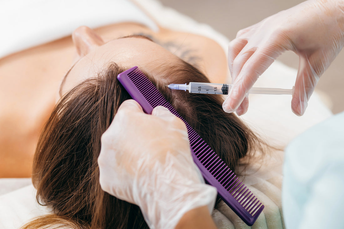 PRP Treatment for Hair